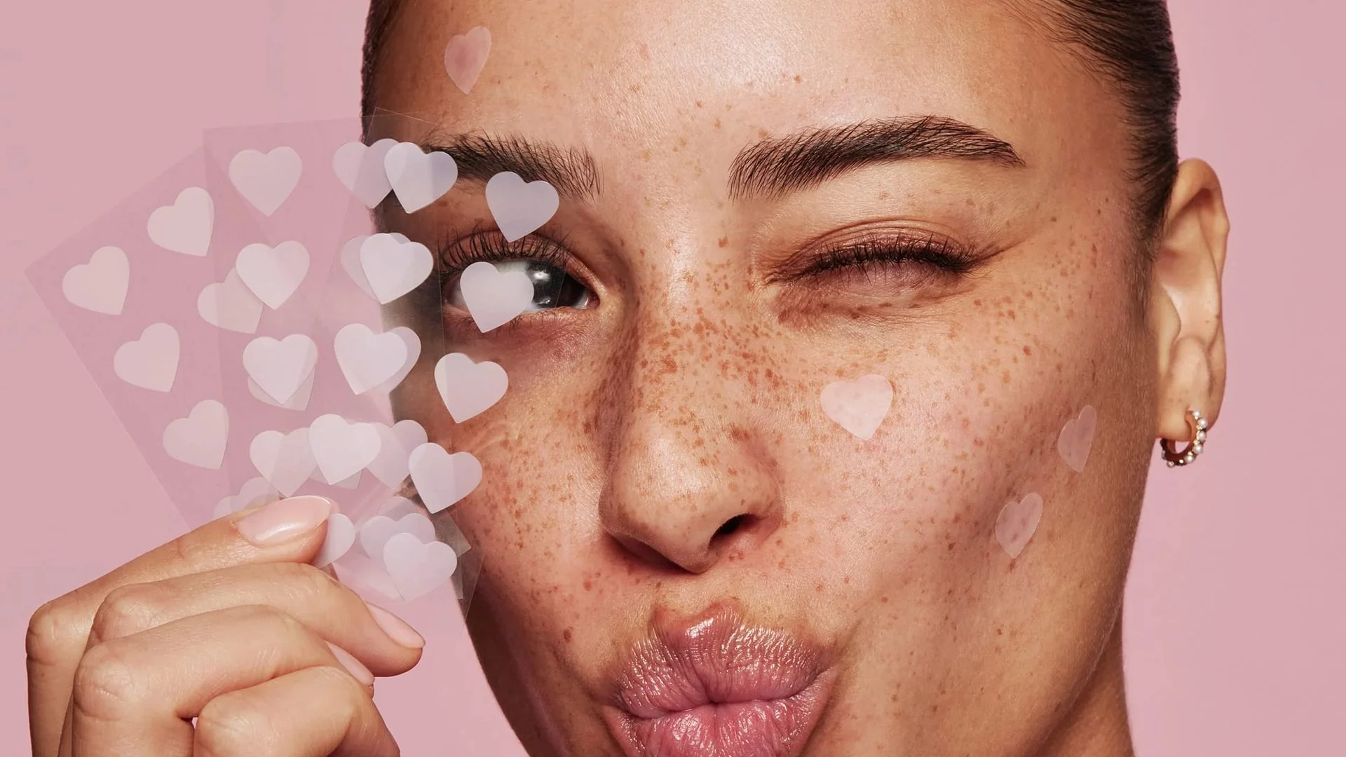 do pimple patches leave scars